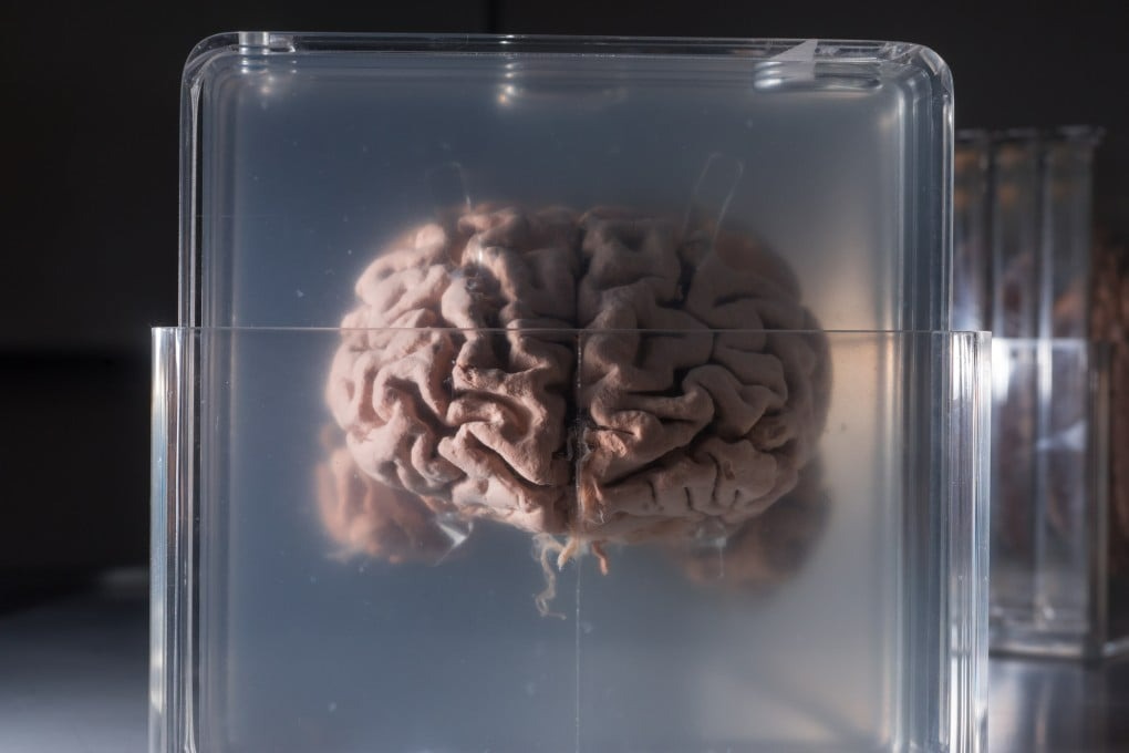 Công nghệ lập bản đồ RNA mới mở ra cơ hội giải mã bộ não Einstein và kho báu di truyền bị lãng quên- Ảnh 1. Công nghệ lập bản đồ RNA