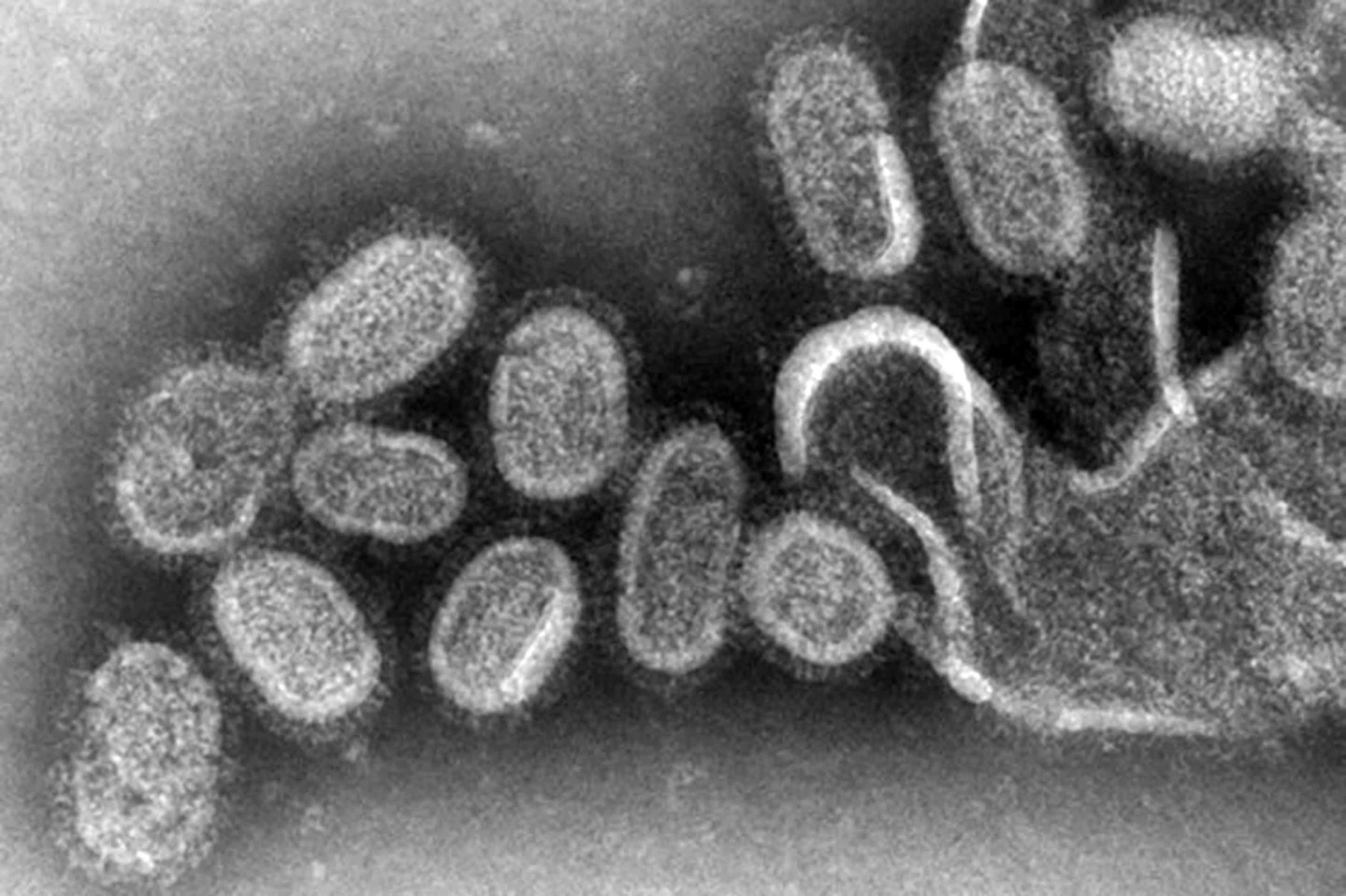 Quan sát dưới kính hiển vi dấu chân tử thần trên mô sống